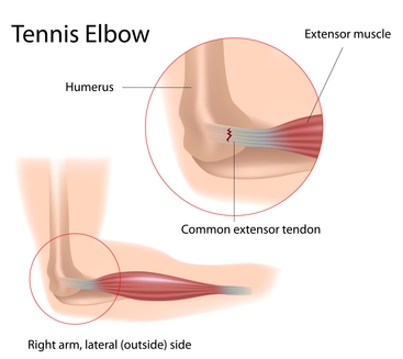 anatomy of the elbow